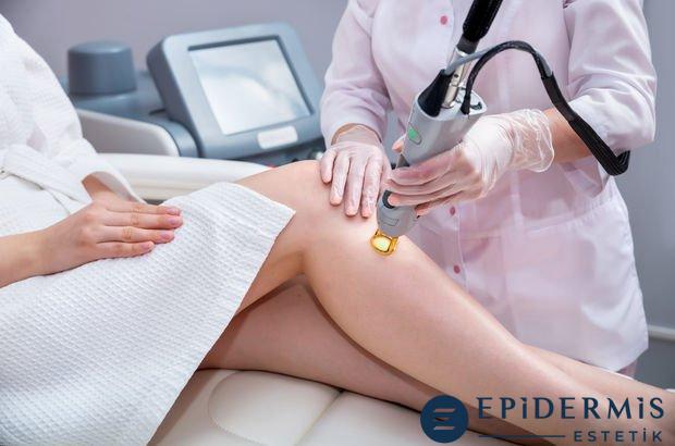 Lazer Epi̇lasyon Kaç Seans Sürer