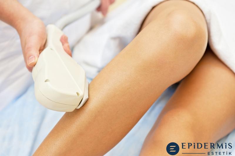 Her Cilt Rengine Lazer Epilasyon Uygulanır Mı?