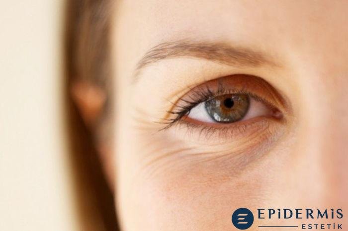 Göz Çevresi Kırışıklıkları